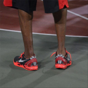Kobe Bryant's Achilles surgery leaves large scar