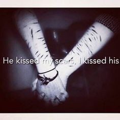 Kiss, Heart, Cant Living, Kissing Scars, Emo Boys Kissing, Emo Quotes ...