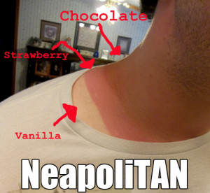 funny sunburn looks like neopolitan ice cream funny photo funny pics