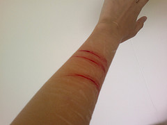 Cuts On Arms Blood arm help depression