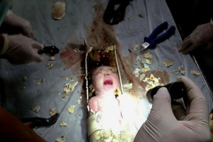 Chinese baby rescued from toilet pipe after being flushed away by his ...