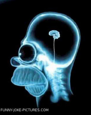 Funny X-Ray Photo Images Homer Simpson