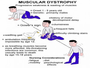 Muscular dystrophy drug approved