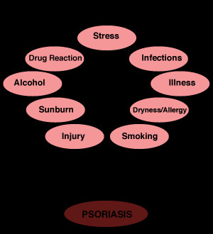Psoriasis Trigger Factors