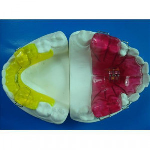 Twin Block Appliance China orthodontic Laboratory appliance retainer