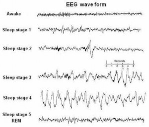 Stages of Sleep: Slow Wave and REM