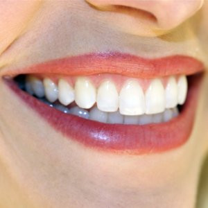 of knowing white teeth secrets and having perfectly straight teeth ...