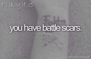 Battle scars