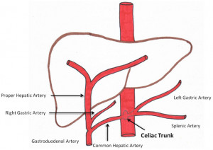 Figure 1 Schematic representation of celiac arterial anatomy