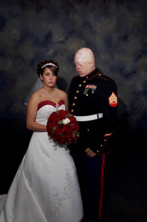 wounded marine returns home to wed wounded marine sgt ty