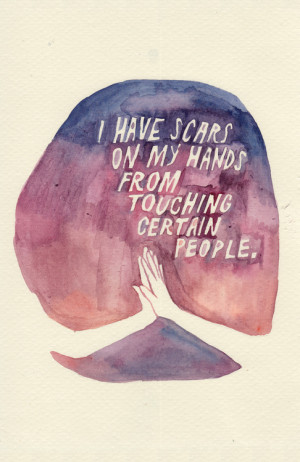 have scars on my hands from touching certain people.