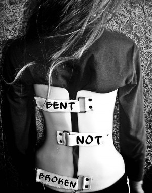 love this!!! Because its the truth scoliosis doesnt break u its just ...