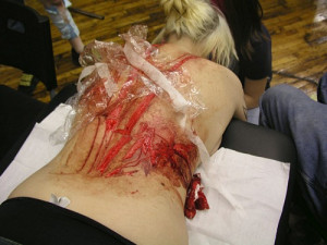 The following are real Scar Tattoos!