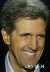 John Kerry Before and After Botox