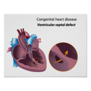 Heart Diagram Shirts Gifts