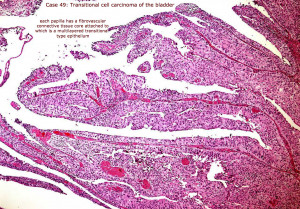 transitional epithelial cells under microscope