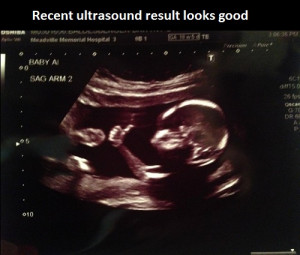 funny-baby-ultrasound-like