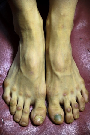 ugly ballet dancer feet gross ballet dancer feet dancer barefoot ...