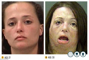 Shocking: Over a period of just three years, this meth addict's entire ...
