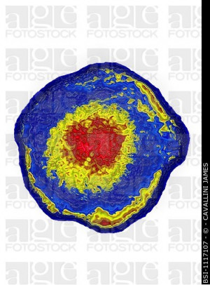 VARICELLA HERPES ZOSTER VIRUS VZV Herpesvirus Varicella zoster