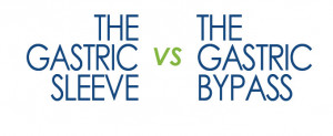 Gastric Sleeve vs Gastric Bypass
