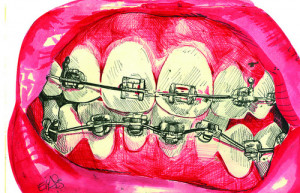 art, braces, drawing, lovely, pink, teeth