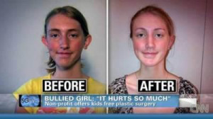 Children and Plastic Surgery