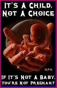 No. Abortion is murder, but this is not an abortion.