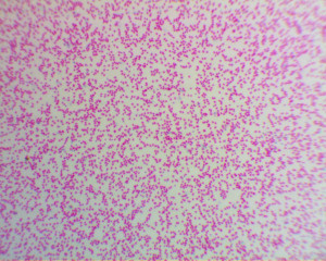 11 Frog Blood Smear labeled as Blood offrgo smear