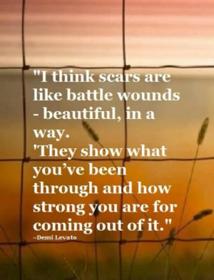 Scars tell a story- that you survived