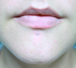 Lip Piercing Retainers