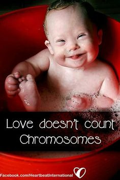 ... Abortion Discrimination in State-Sponsored Down Syndrome Materials