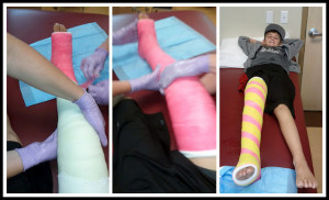 Broken Femur Bone Cast Famous pink & yellow cast!