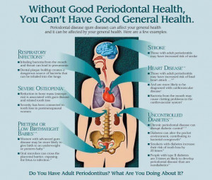 hygienist can help. RT @DrKristallis: Is Periodontal (Gum) Disease ...