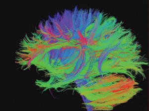 TECHNICOLOR CONNECTIONS: Diffusion tensor imaging imbues axonal nerve ...
