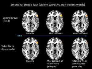 Normal Brains (top) showed more activity when reacting to violent ...