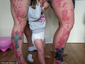 Parents get huge red tattoos on their legs to support their 18-month ...