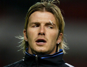 David Beckham was left with a cut eye following the incident