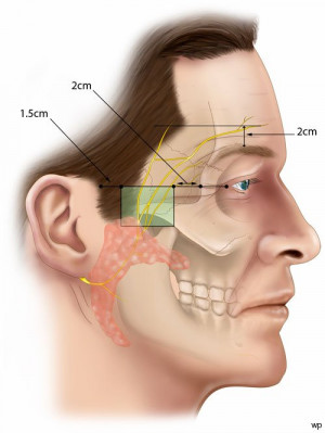 Superficial Temporal Artery and Vein