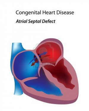 Related Pictures causes of heart disease