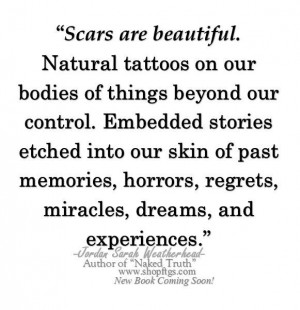 Scars are beautiful....