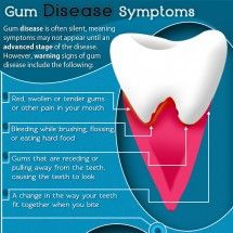 symptoms of gum diseases infographic infographic more disease ...