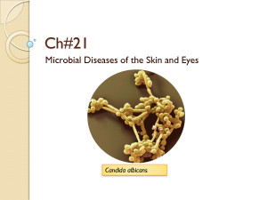 Microbial Diseases The Eye