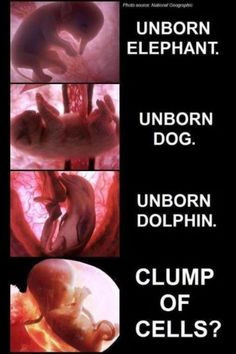 know this is an anti-abortion ad, but I have to say, OMG the ...