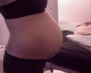 Solution For Stretch Marks