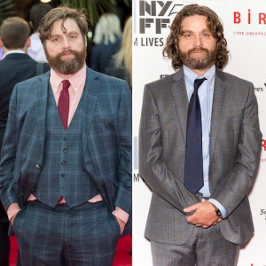 Zach Galifianakis Shows Off Shocking Weight Loss — 7 More Hollywood ...