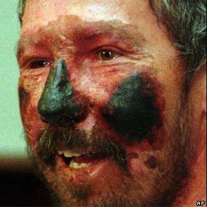 frostbitten but alive during the massive storm on Everest in May 1996 ...