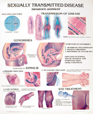 sexually transmitted disease chart