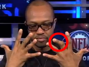 ... Ray Of What His Mangled Finger Looked Like During The Playoffs