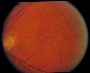 Panorama Optometry Retinal...